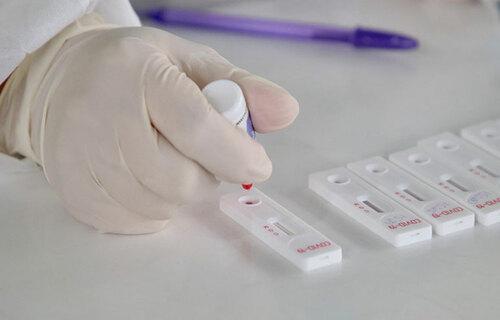 Covid-19: mais de 518,5 milhões de doses da vacina monovalente foram aplicadas no Brasil