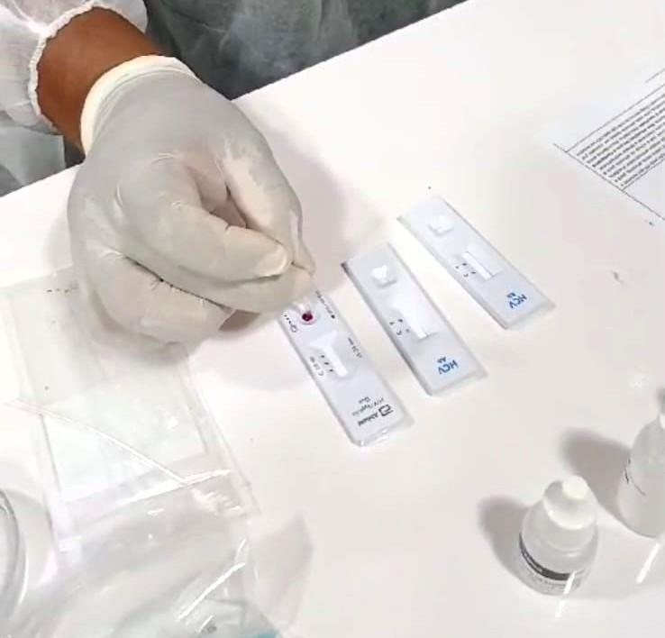 Governo Presente: FVS-RCP realiza mais 432 testes rápidos para diagnósticos de Infecções Sexualmente Transmissíveis
