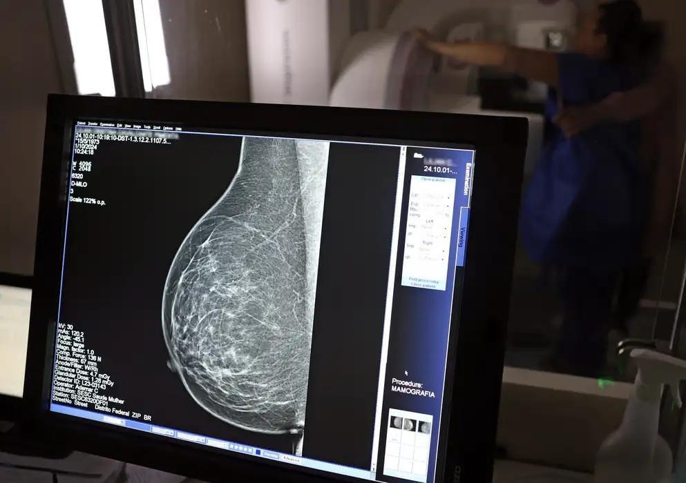 Quase 70% dos brasileiros consideram câncer evitável, apesar de 65% não saberem como se prevenir