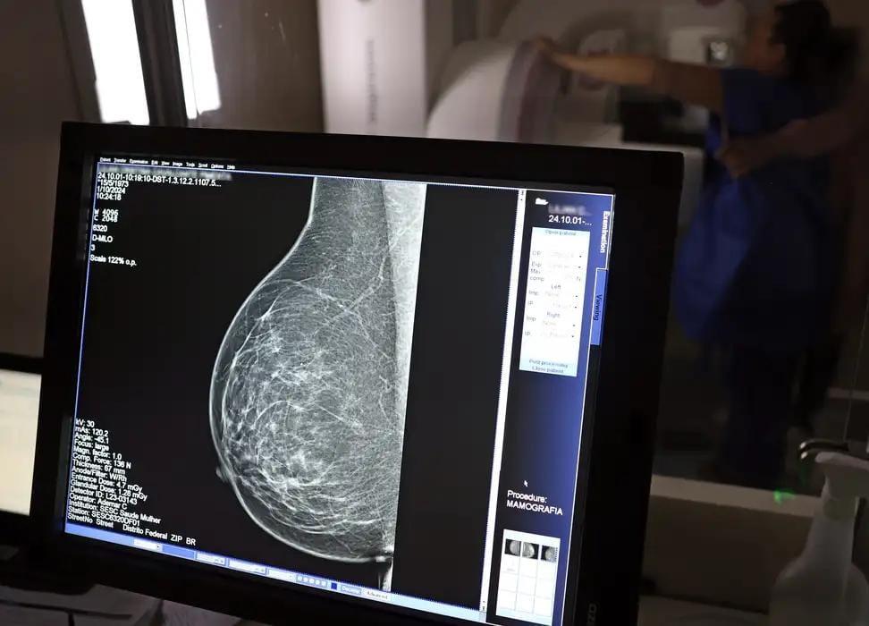 Quase 70% dos brasileiros consideram câncer evitável, apesar de 65% não saberem como se prevenir