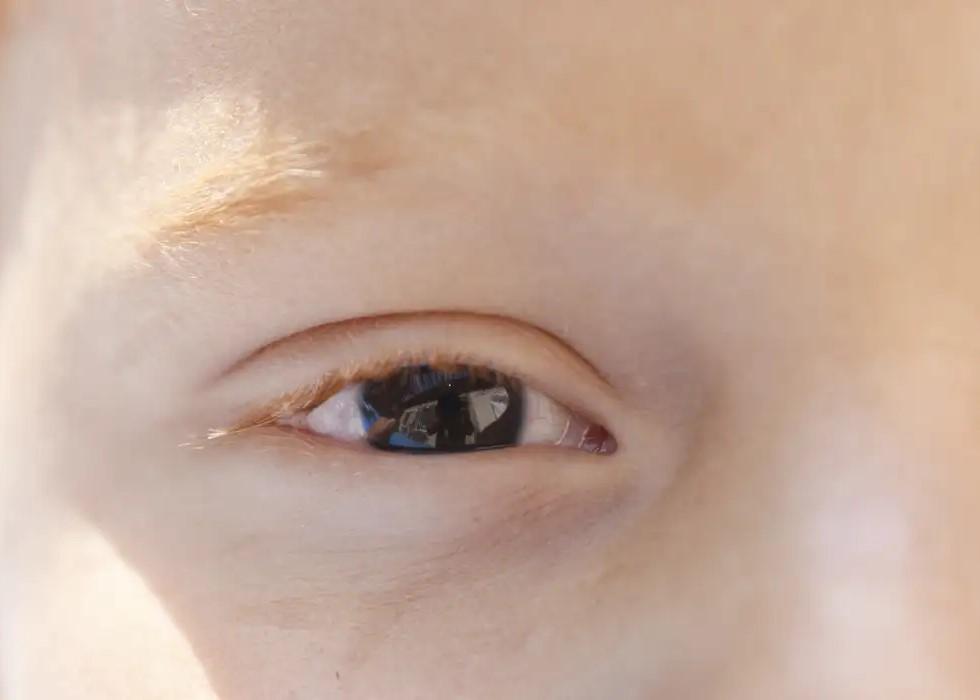 Cartilha sobre saúde ocular na infância orienta pais e professores