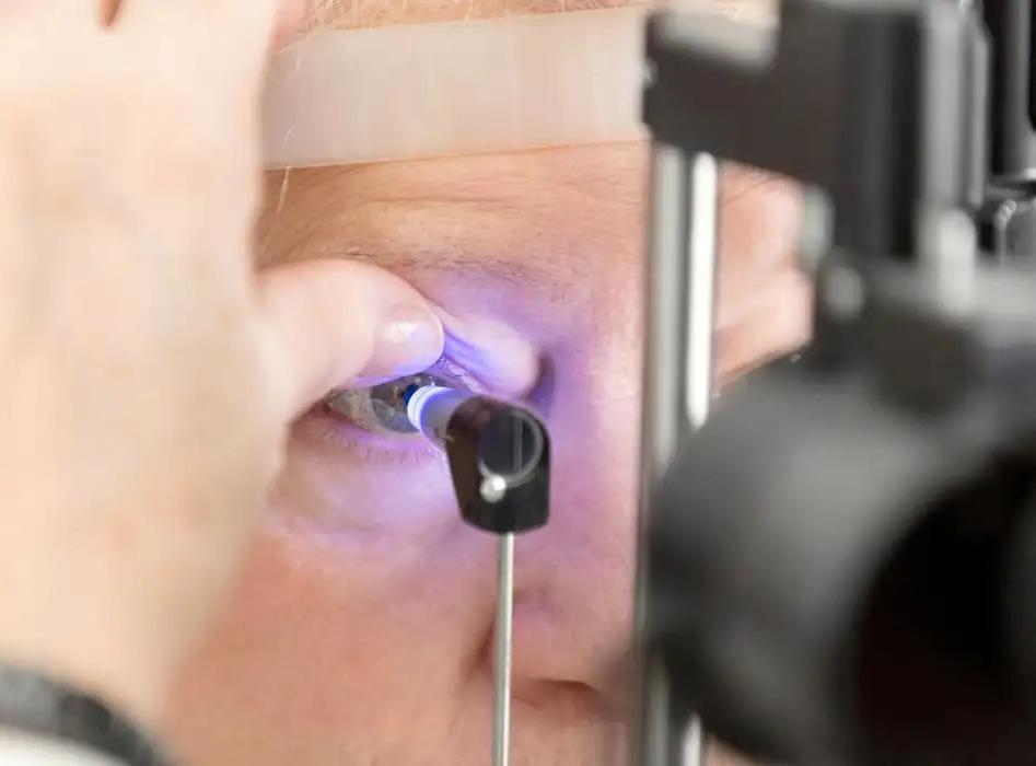Saúde quer padronizar abordagem para eliminação do tracoma no Brasil