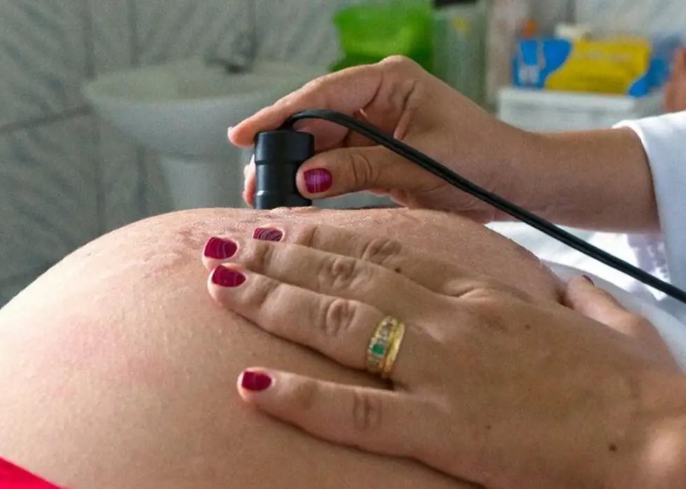 Assistência ao parto avança no Brasil, mas pré-natal ainda preocupa