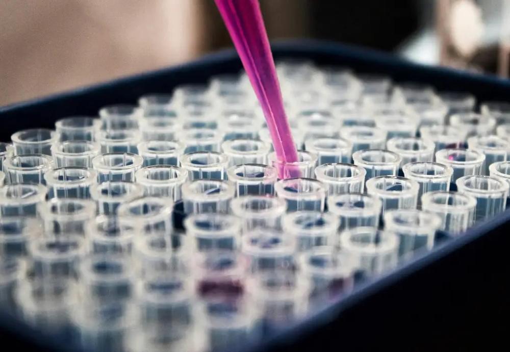 Pesquisas brasileiras avançam no diagnóstico de Alzheimer