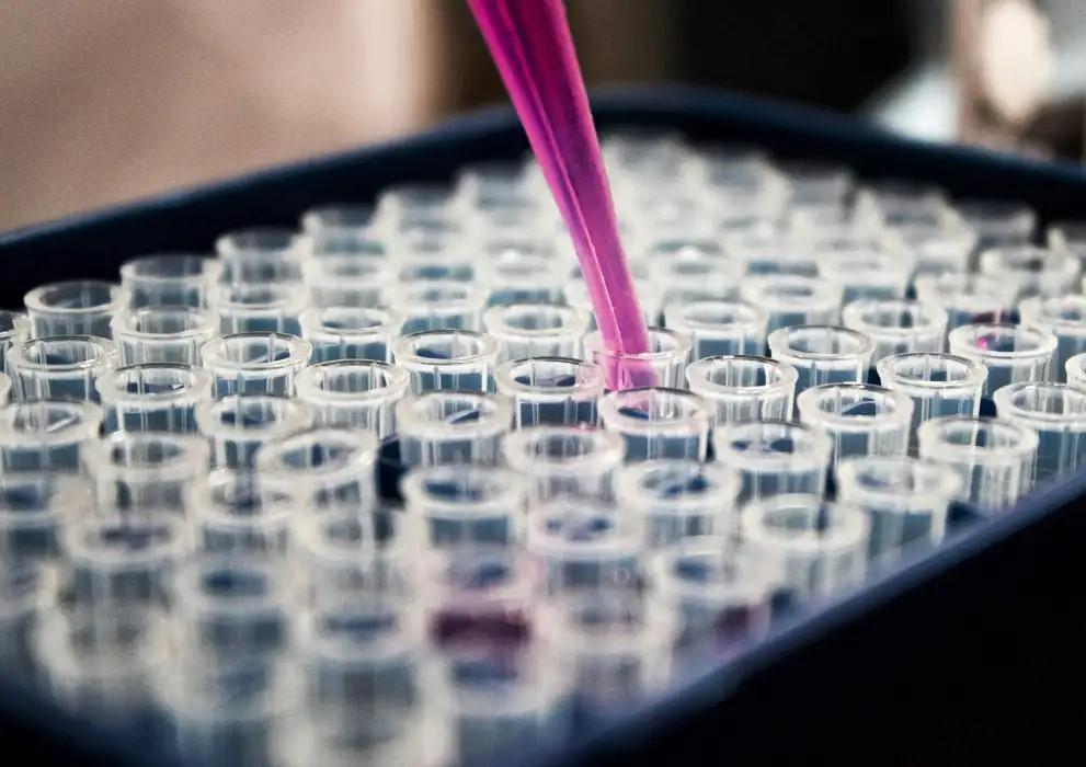 Estudo mostra que inflamação no cérebro pode ser chave do Alzheimer