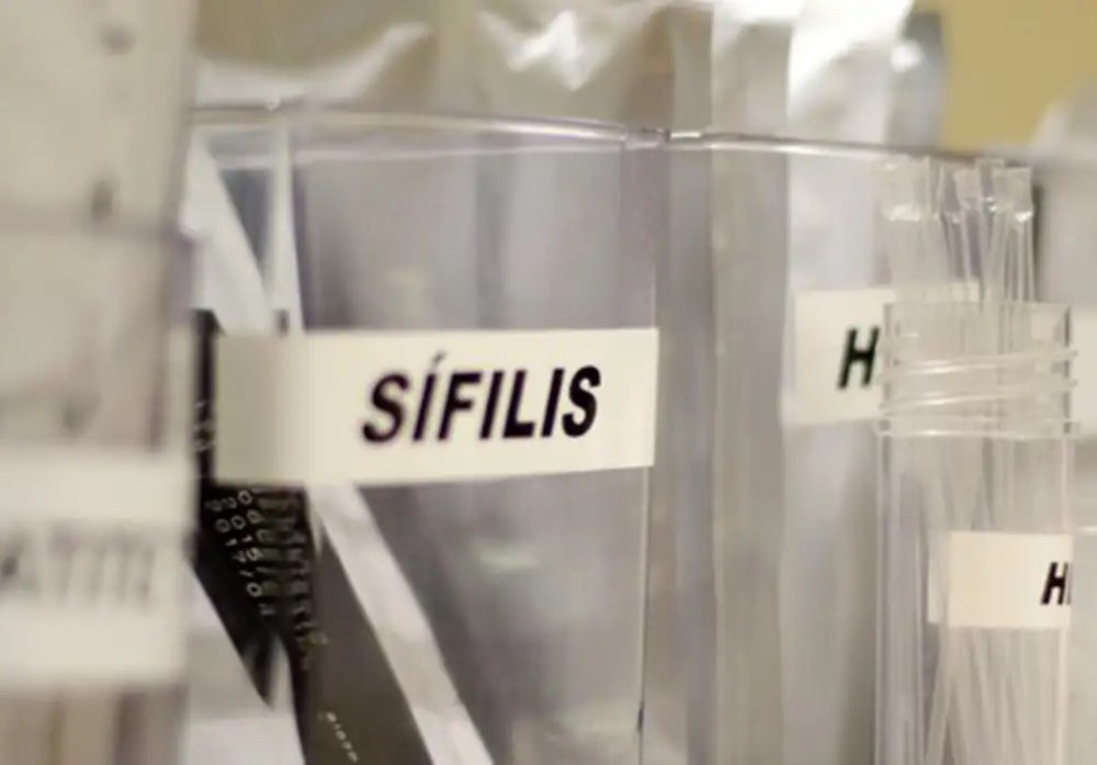 SUS passa a adotar antibiótico para prevenir sífilis e clamídia
