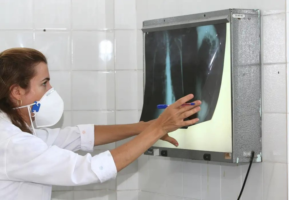 OMS recomenda testes de diagnóstico rápido para erradicar tuberculose