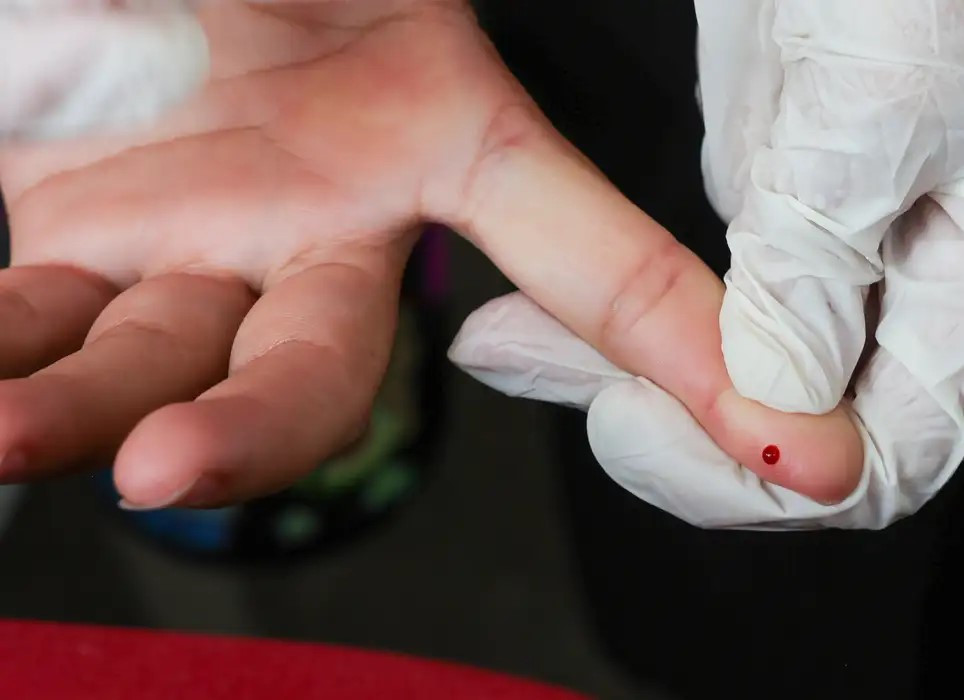 SUS passa a oferecer teste rápido de dengue