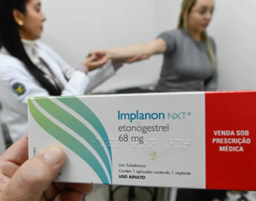 SUS qualifica profissionais para ampliar oferta de implantes hormonais
